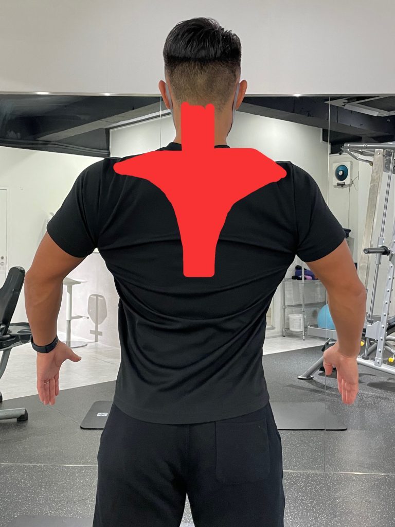 背中にある筋肉：僧帽筋を示した写真