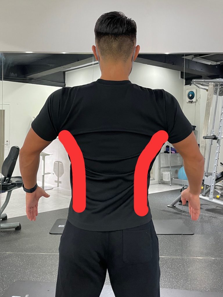 背中にある筋肉：広背筋を示した写真